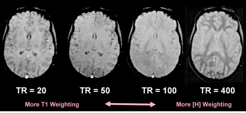 Spoiled GRE contrast