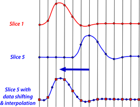 Slice timing correction fMRI